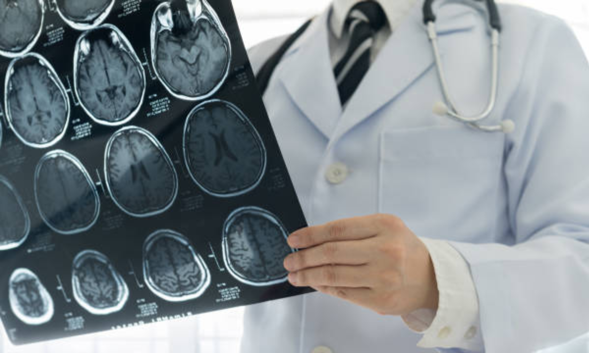 MRI scan in Bangalore