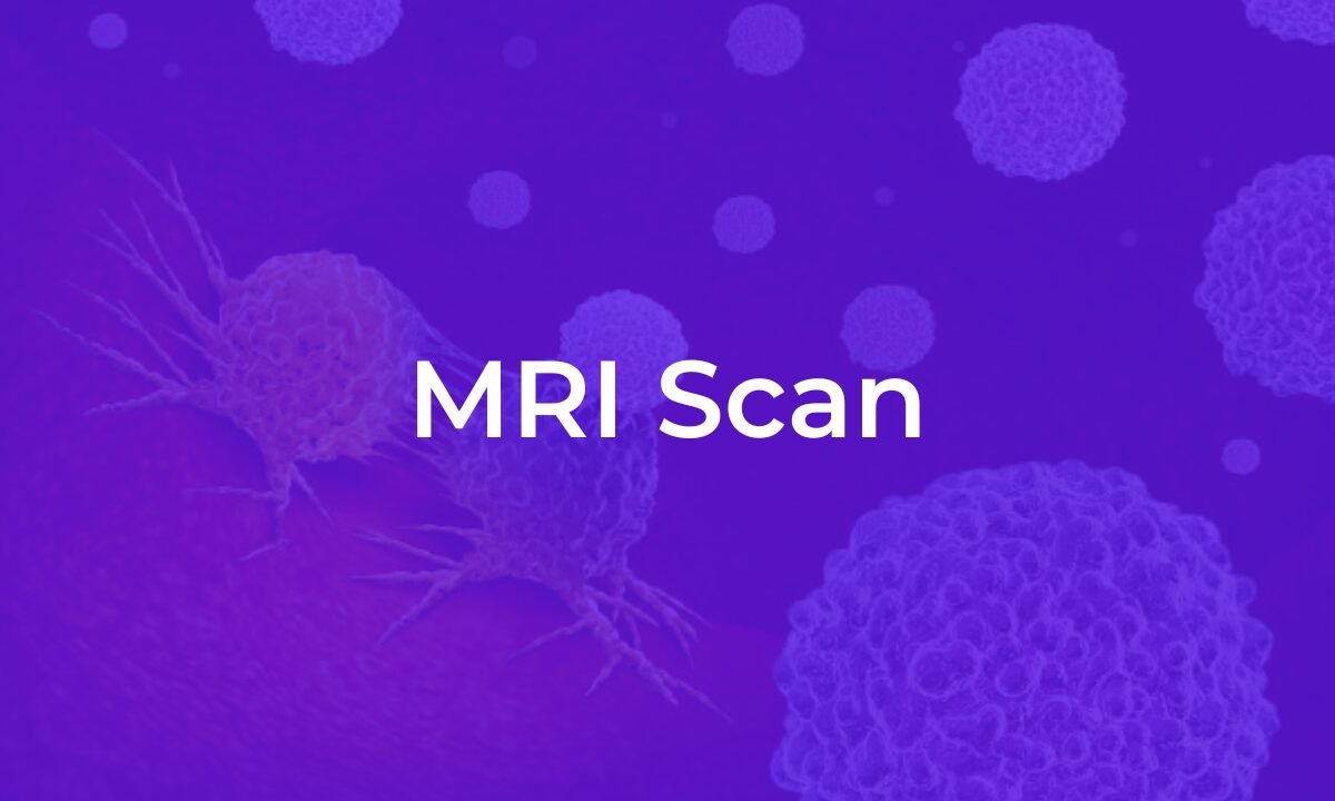 MRI Scan