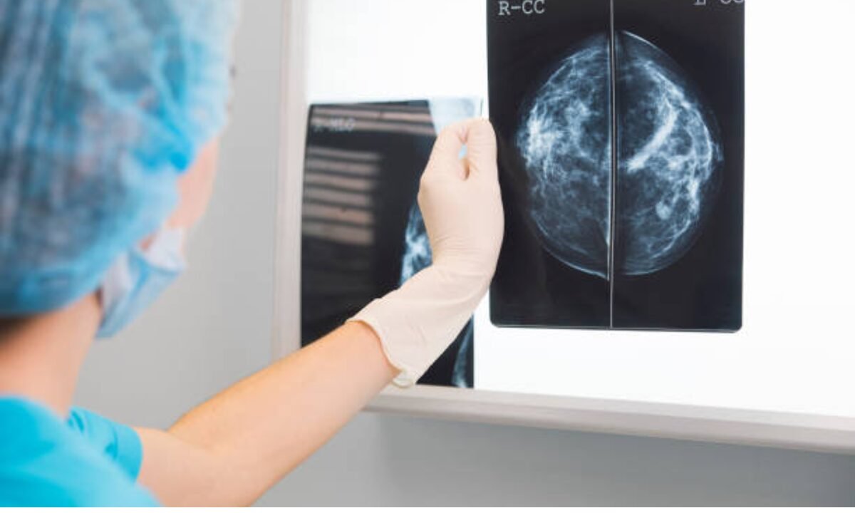 mammography in bangalore