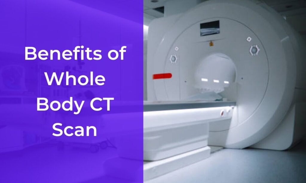 cost of ct scan bangalore