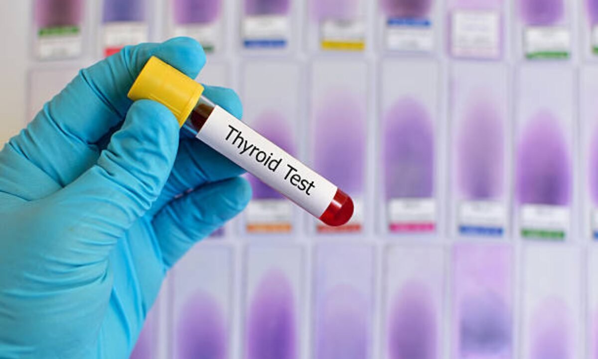 thyroid function test