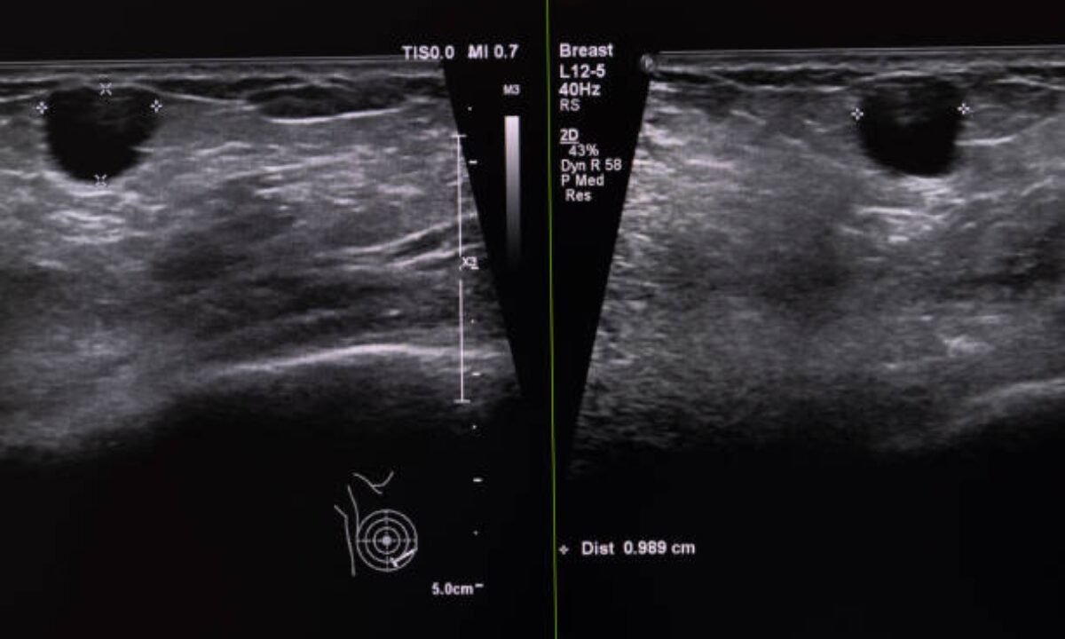 ultrasound scan in bangalore