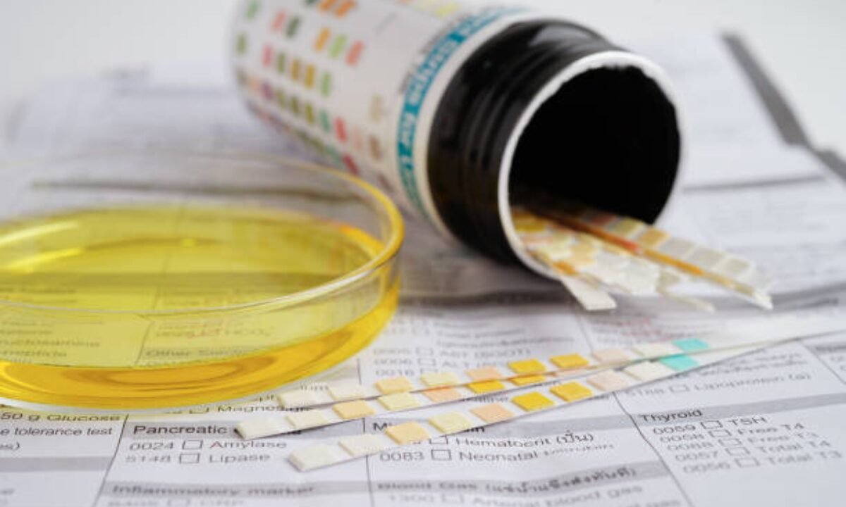 Urine test in Bangalore