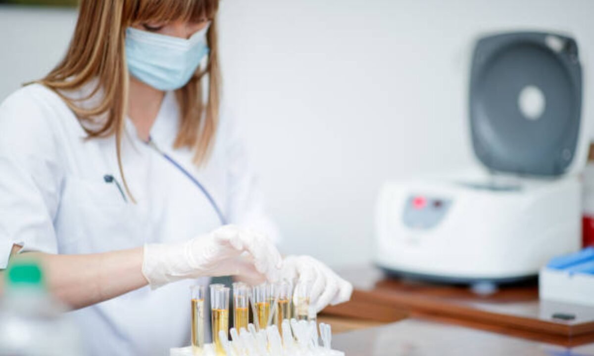 Urine test in Bangalore