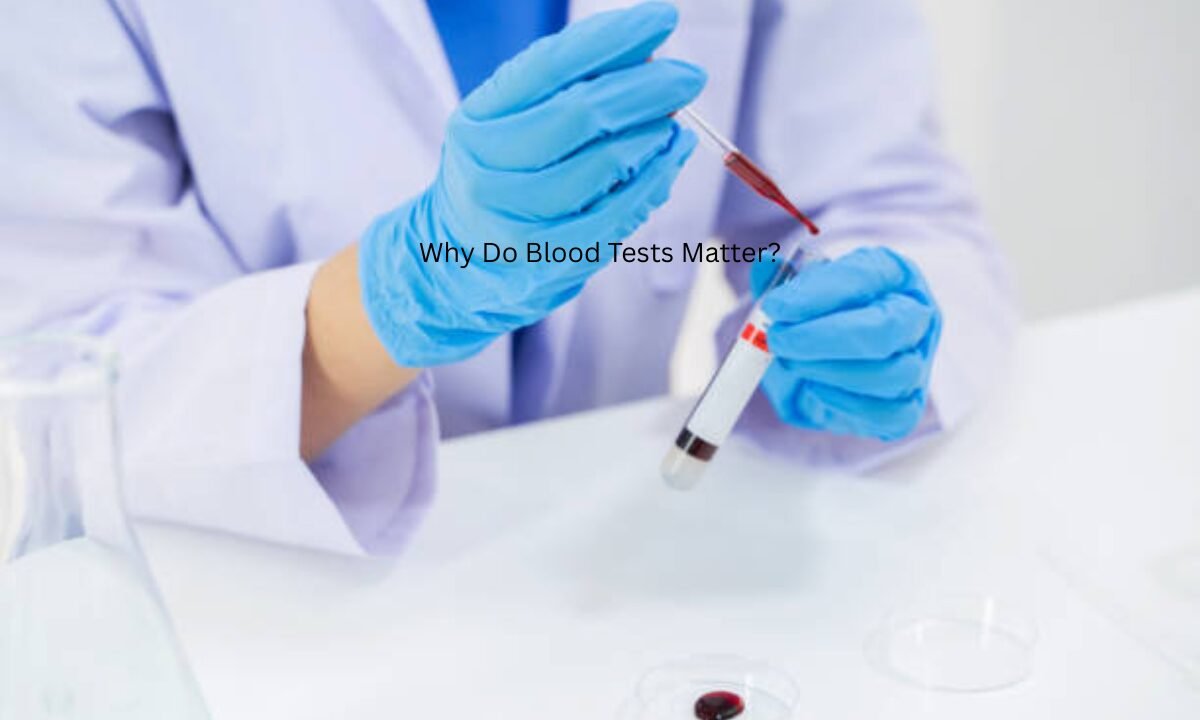 Blood tests in Bangalore
