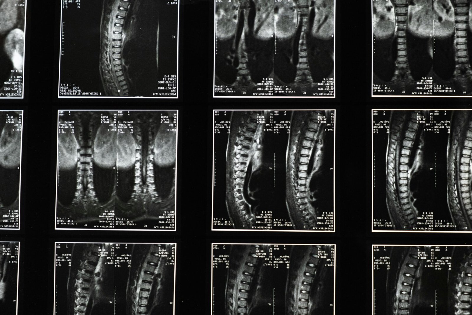 mri scan centre in bangalore