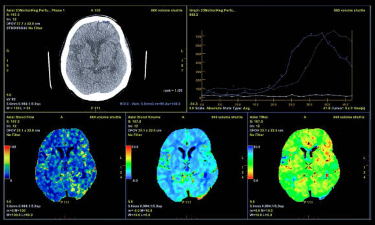 MRI scan in Bangalore