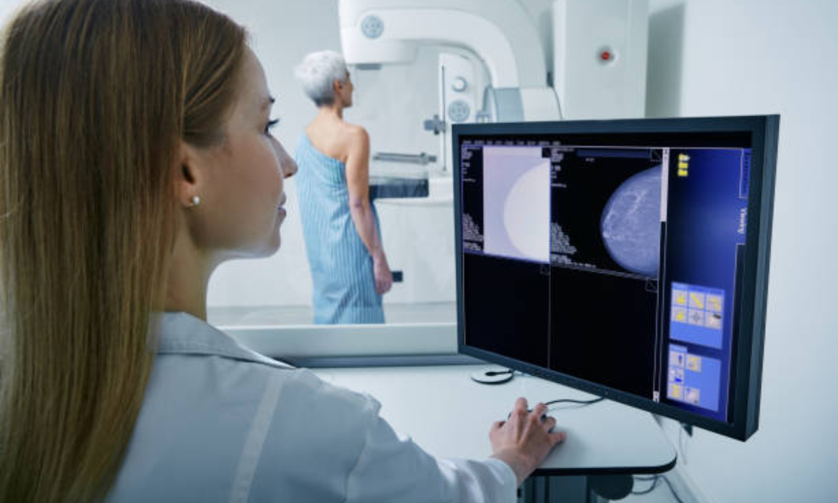 Mammography