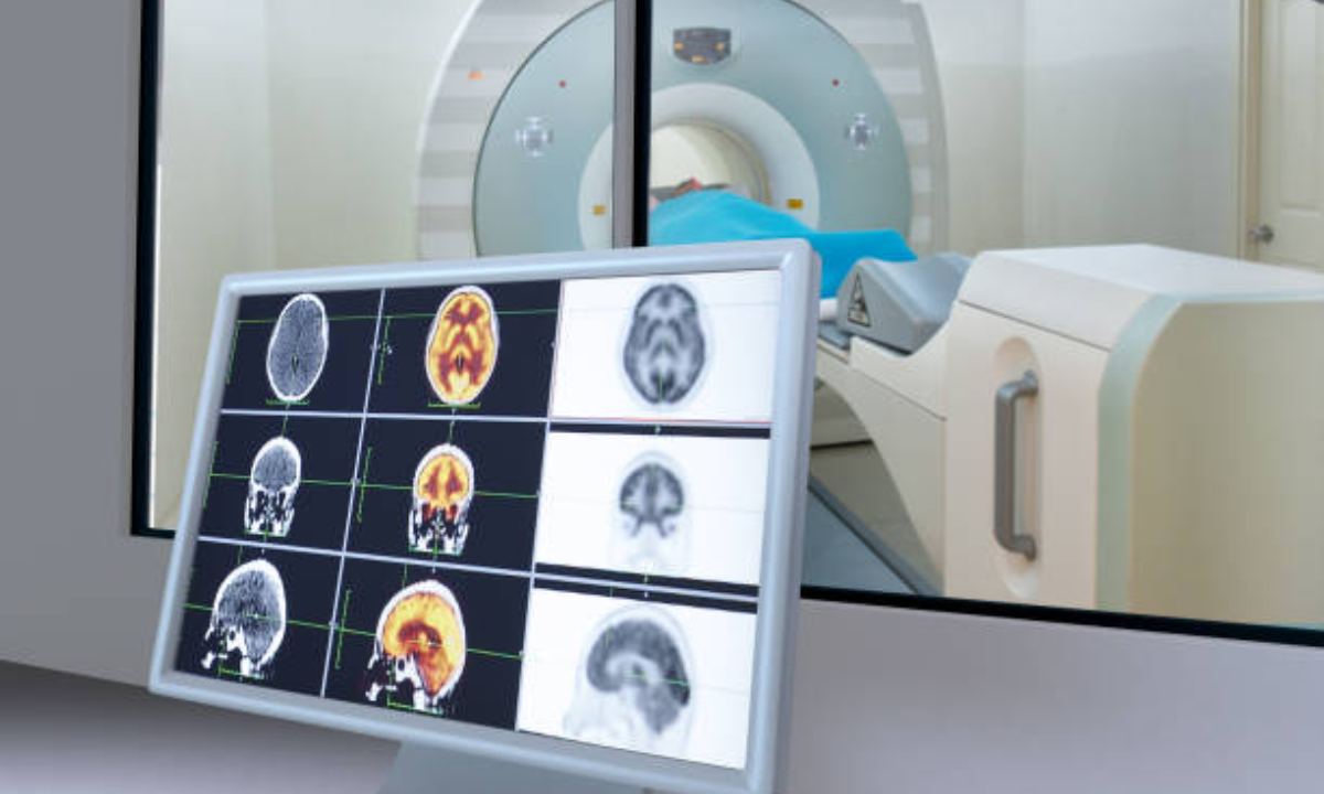 PET CT scan