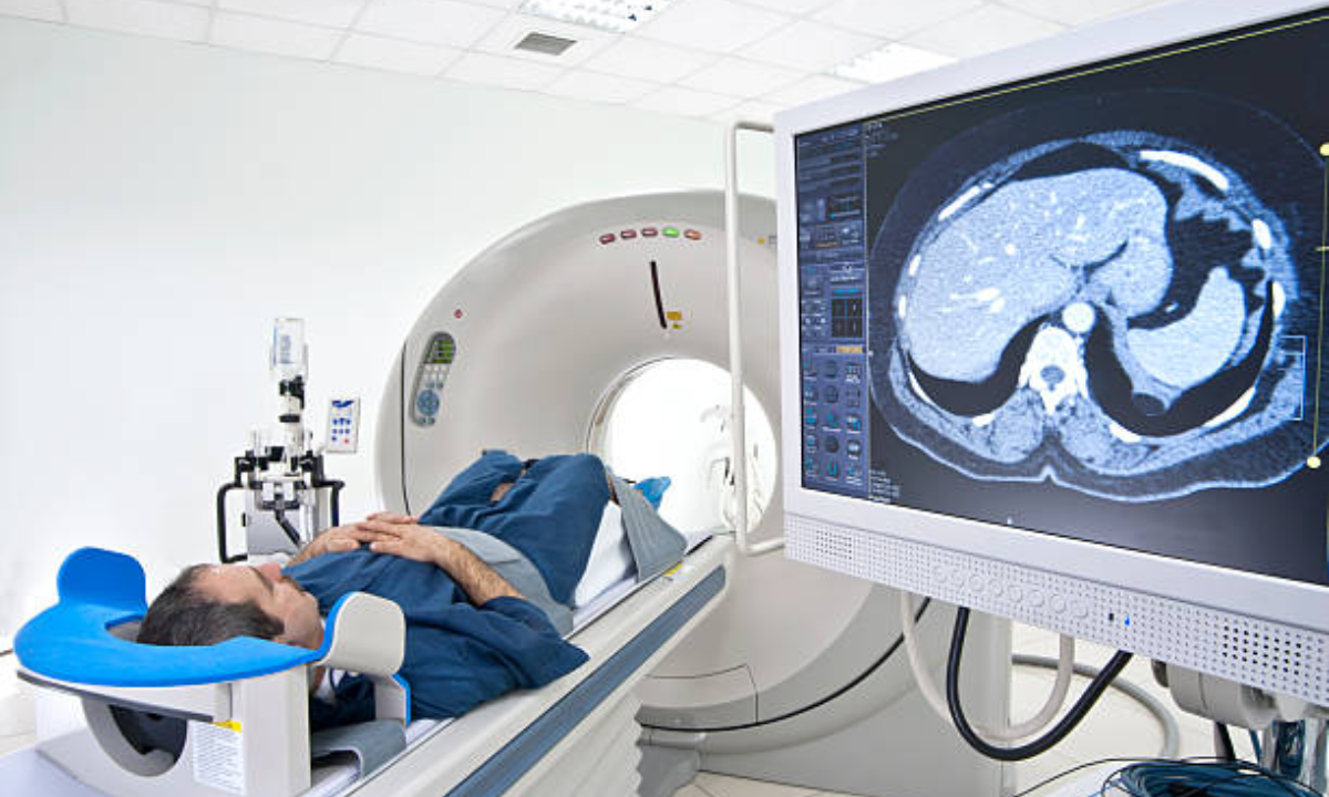 PET CT scan
