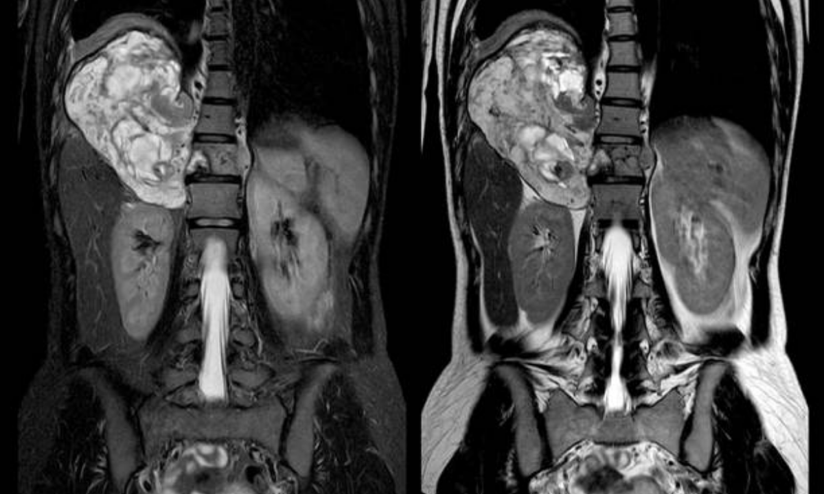 CT scan in Bangalore
