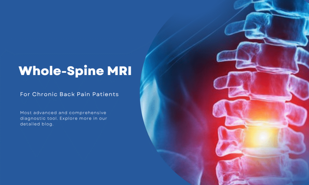 Whole Spine MRI Scan in Bangalore