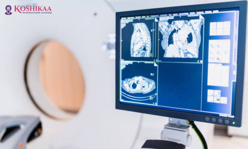 CT Scan: What It Is, Types, Purpose, Procedure and Results