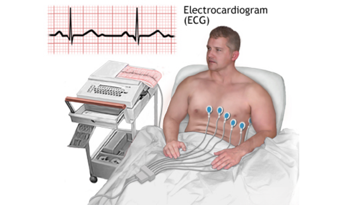 What Does an ECG Do?