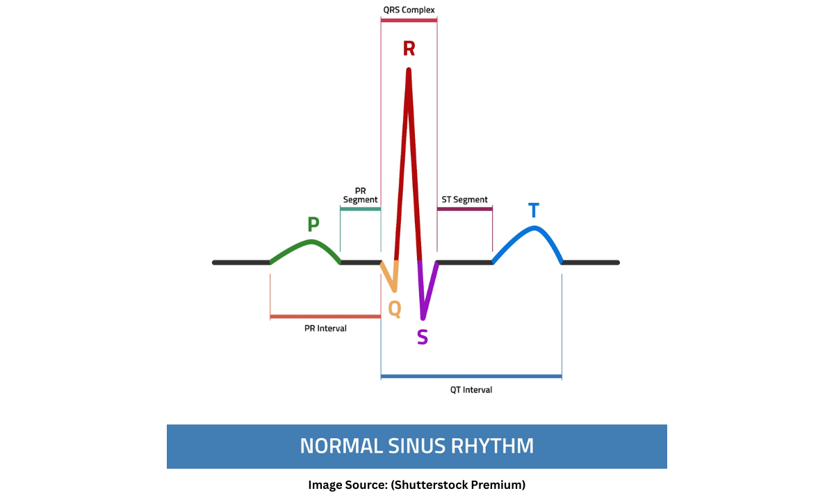 ECG Working Explained