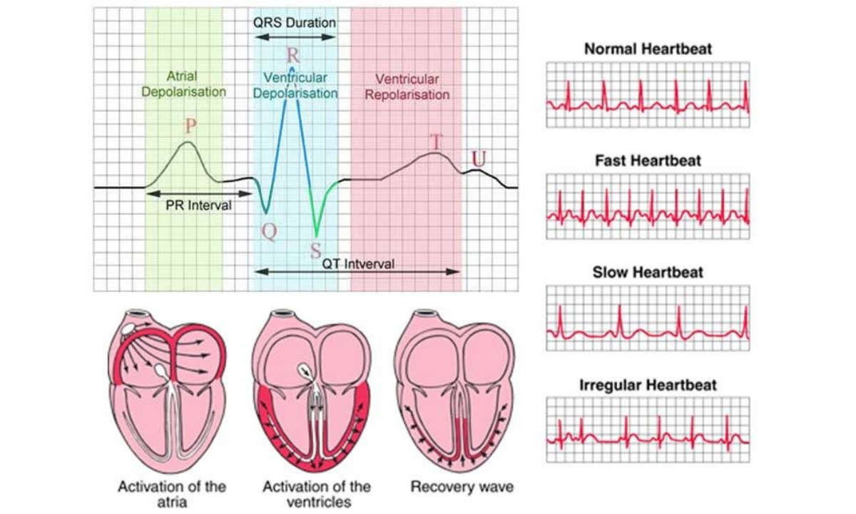 How to Read ECG Test Results