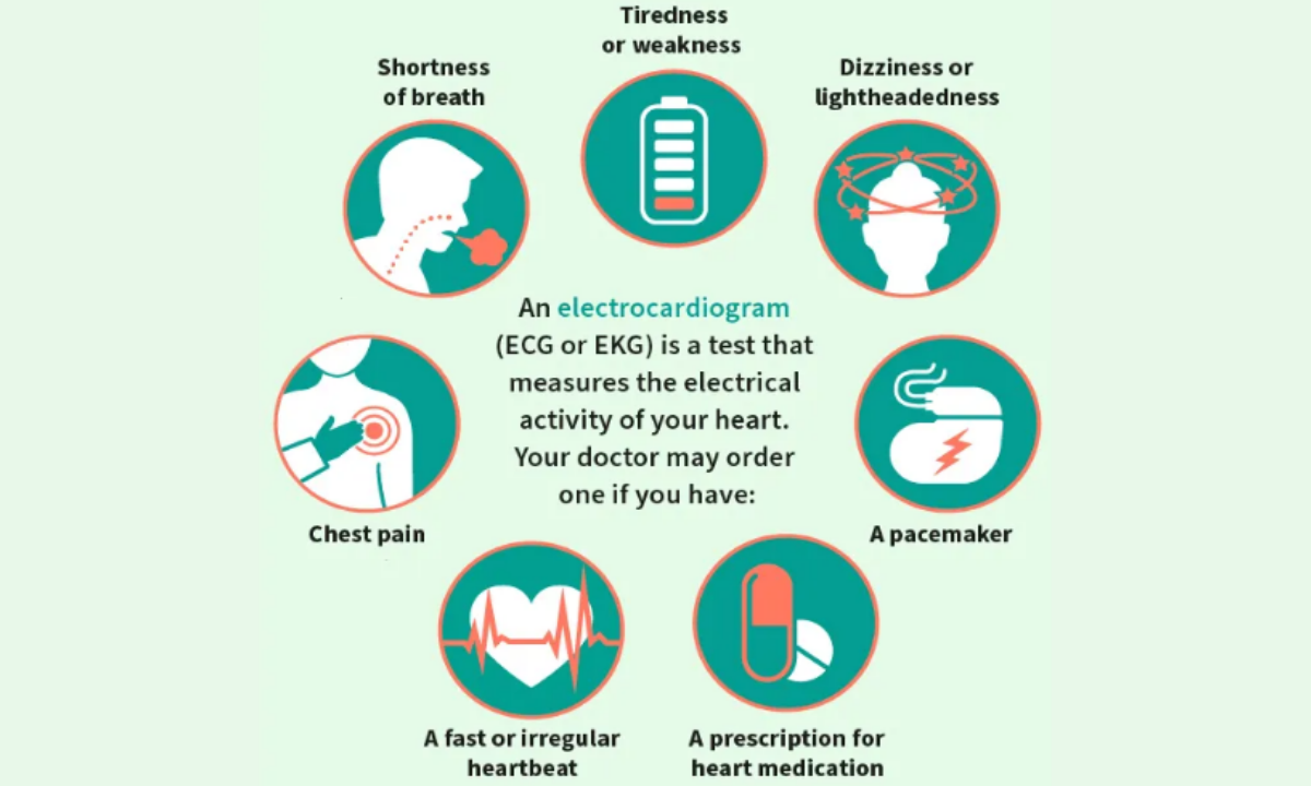 When Is an ECG Required?