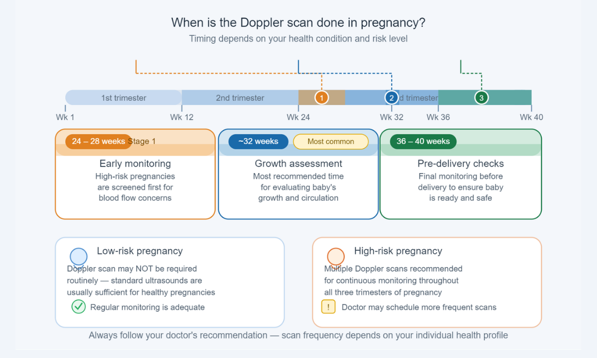 Timing of Doppler Scan