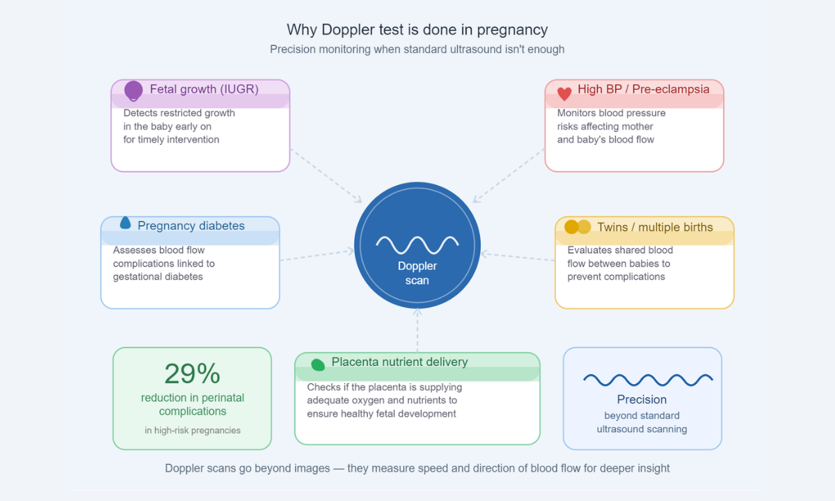 Why Doppler Scan Is Done
