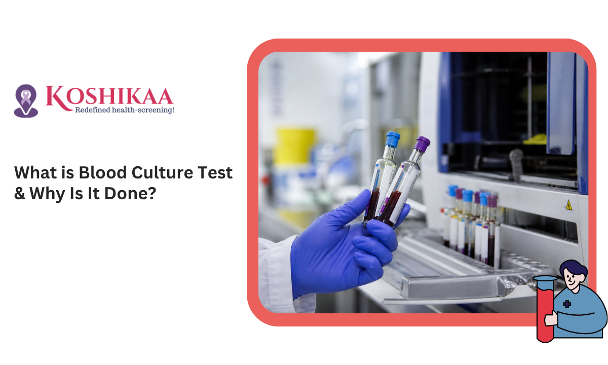 Blood culture test