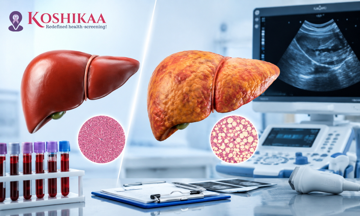 Fatty Liver Disease