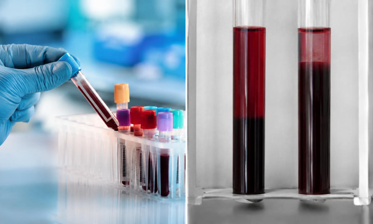 Monitoring Systemic Inflammation