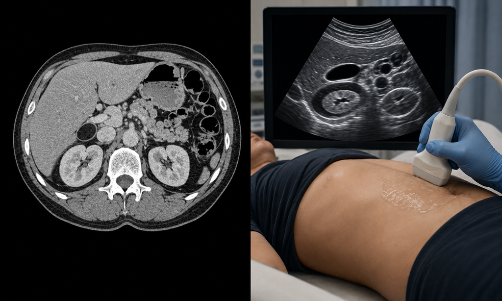 Abdominal CT scan vs ultrasound comparison